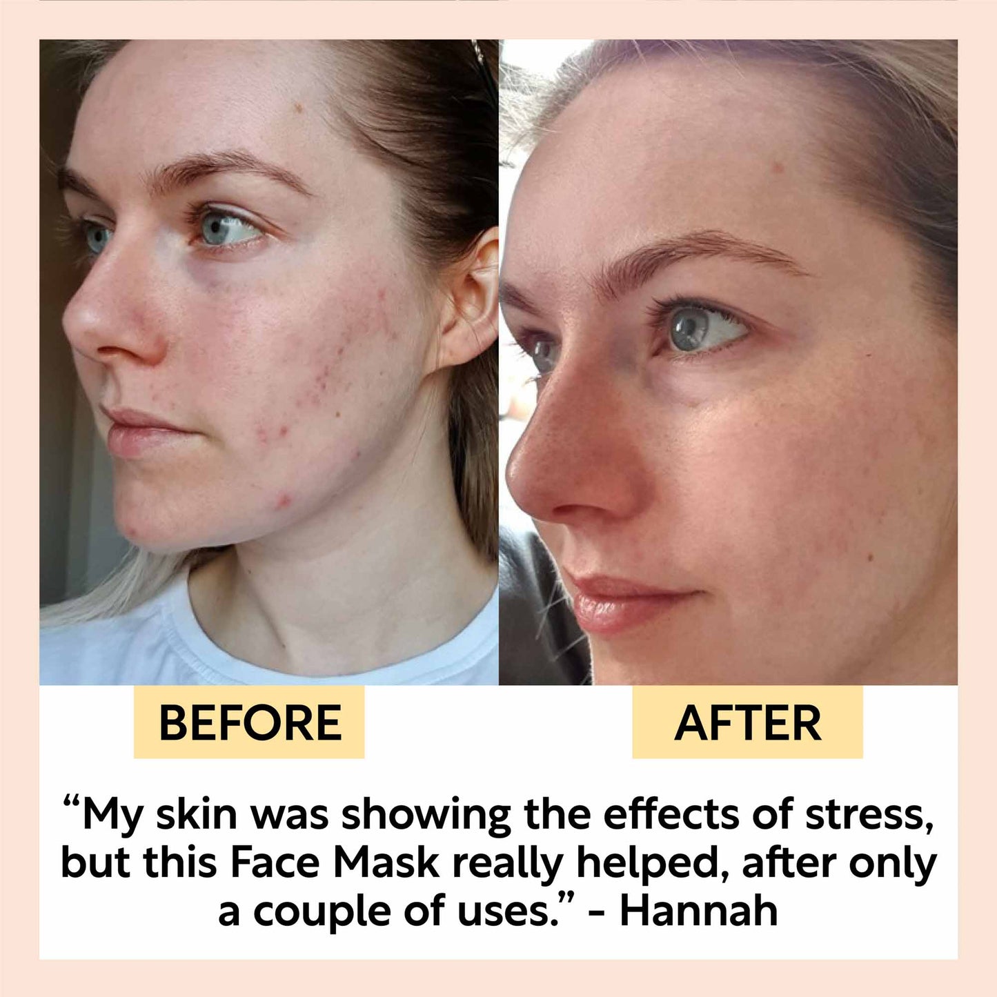Kaolin Clay Face Mask - M2G