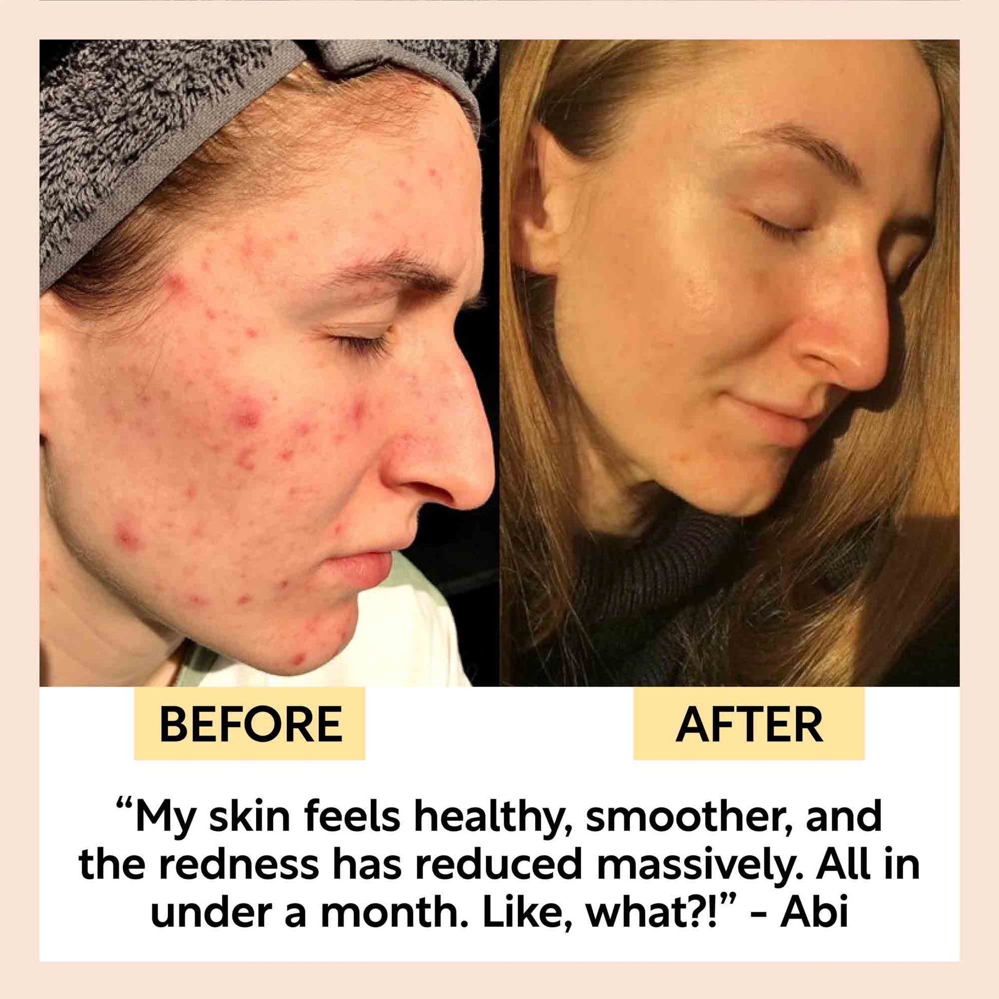 Kaolin Clay Face Mask - M2G