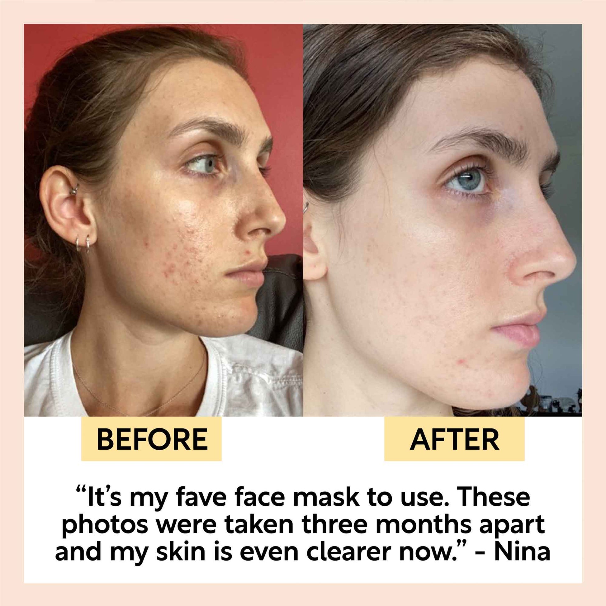 Kaolin Clay Face Mask - M2G