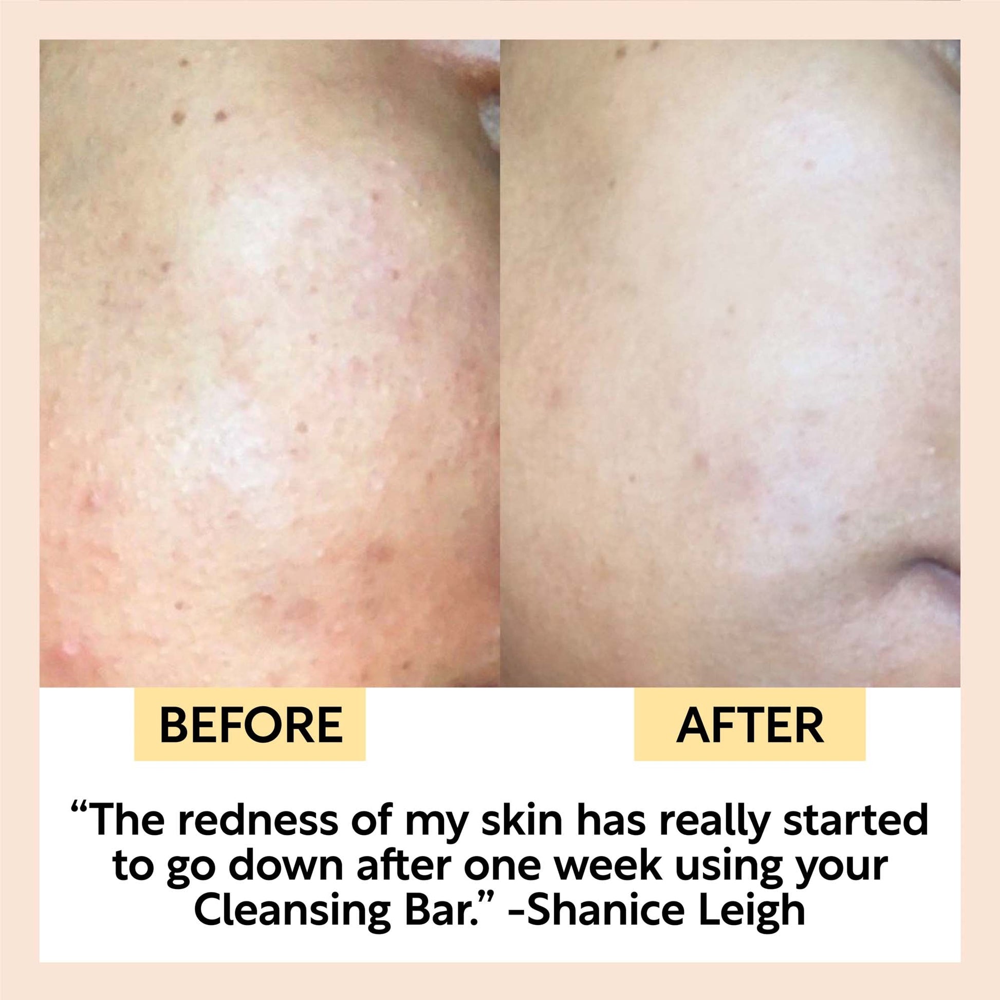 Chai Soap Cleansing Duo - M2G
