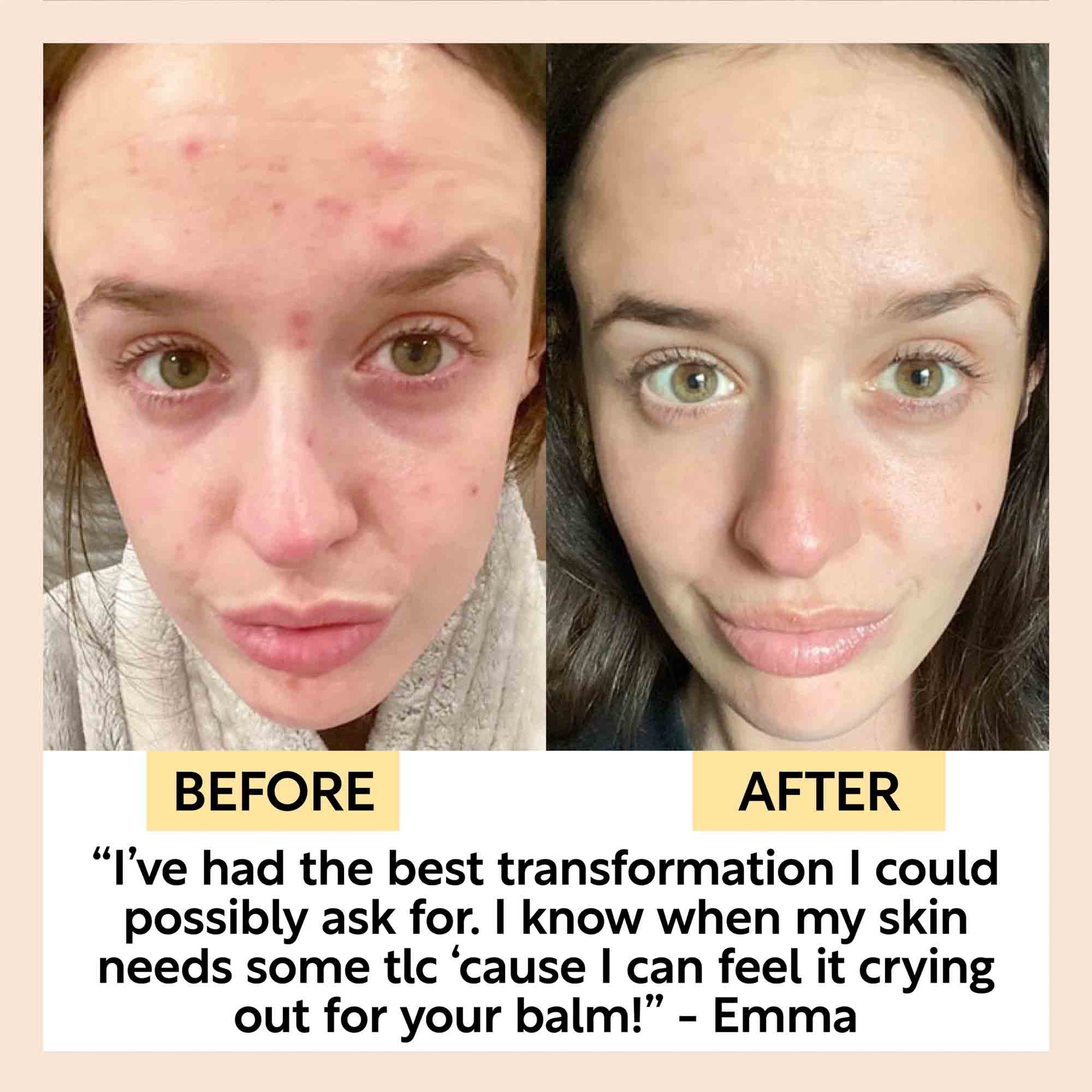 Cleansing Face Balm with Oat Oil + Vitamin E - M2G