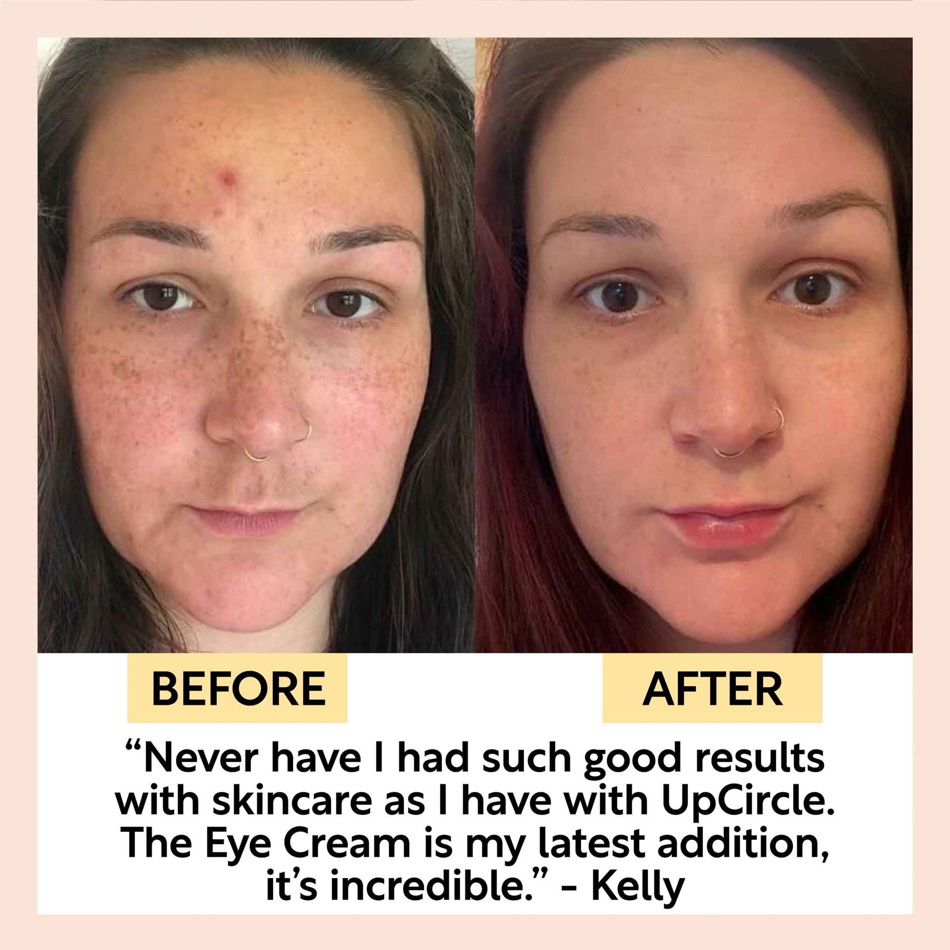 Eye Cream with Hyaluronic Acid & Coffee - M2G