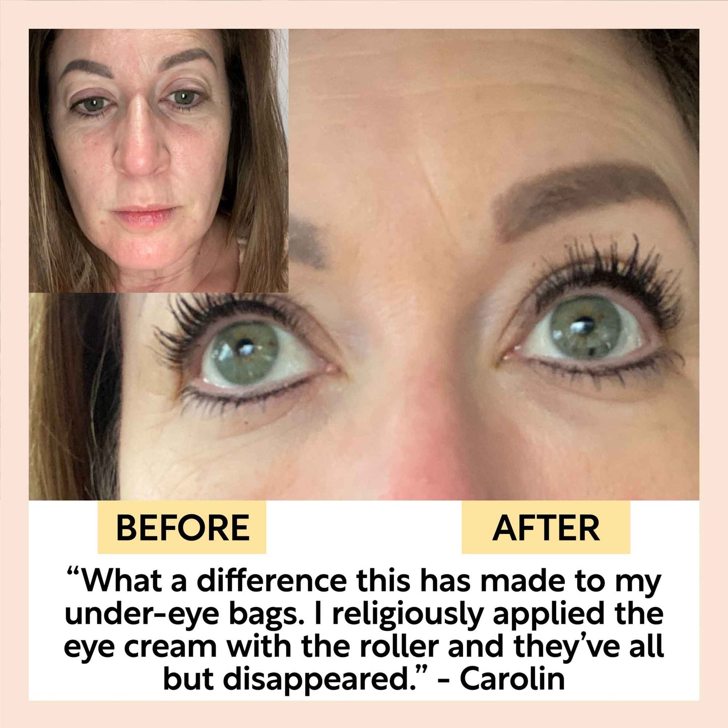 The Caffeinated Duo + Eye Roller Deal - M2G