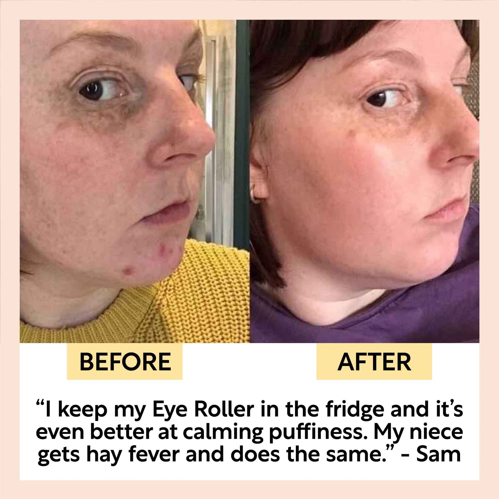 Soothing Eye Roller - M2G