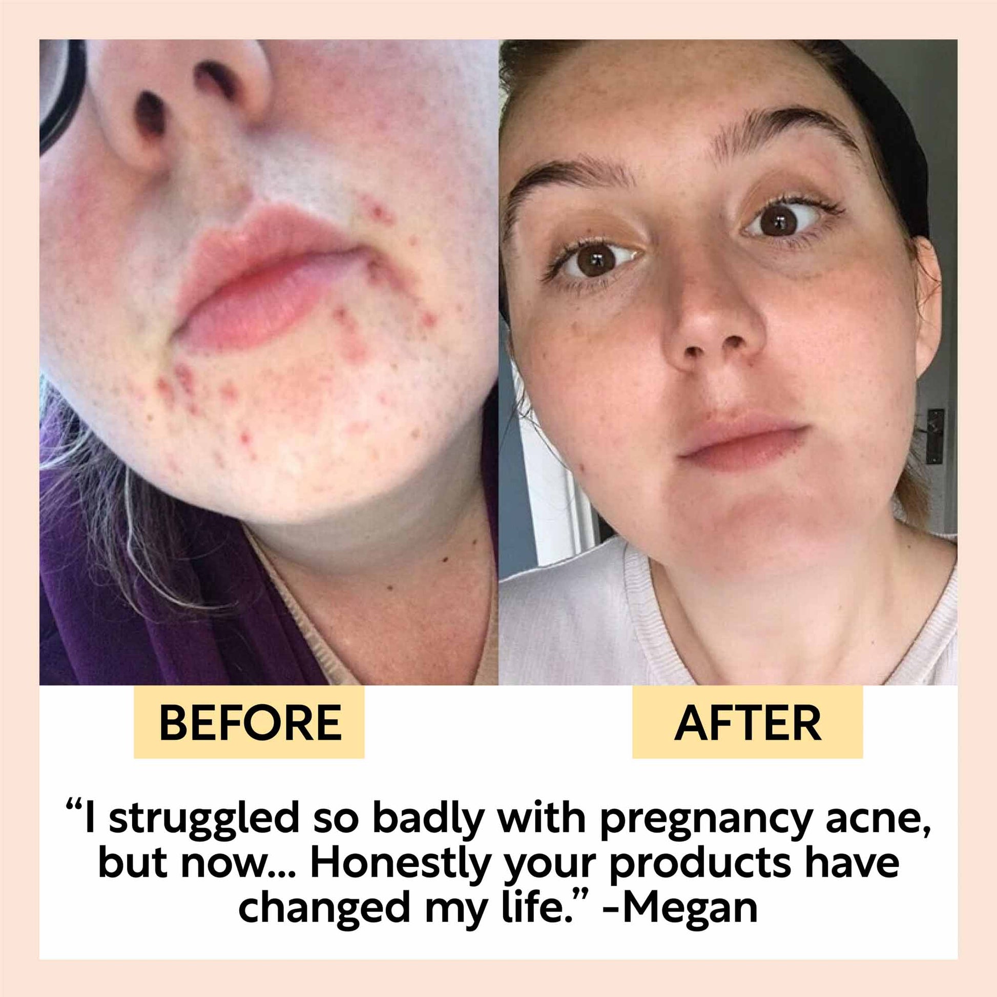 Cleanse, Tone + Moisturize Set - M2G