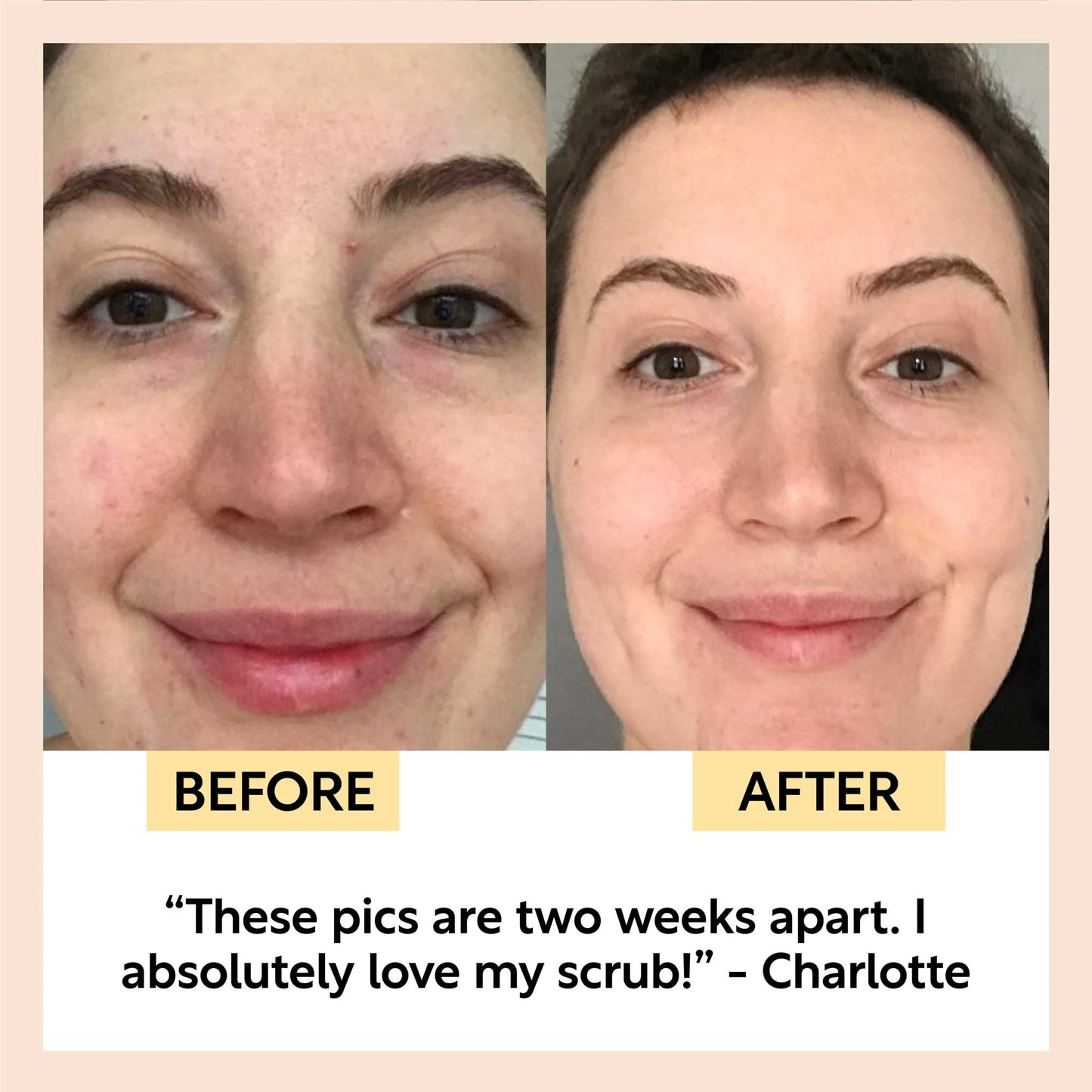 Travel-Size Skincare Bundle - M2G