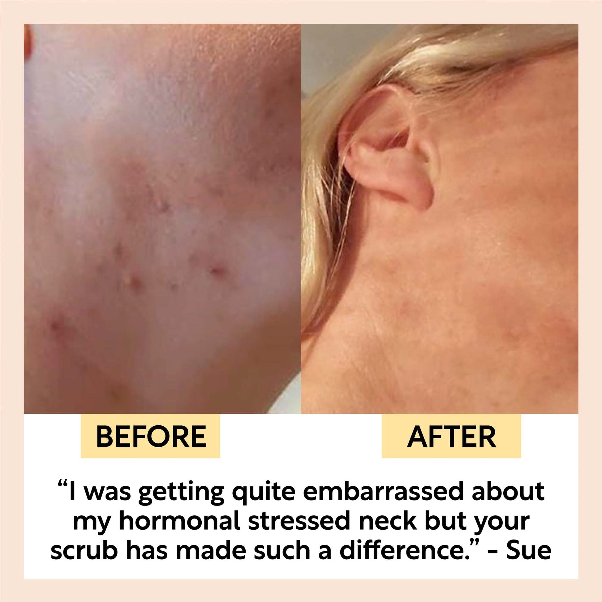 Face Scrub with Coffee + Rosehip Oil - M2G