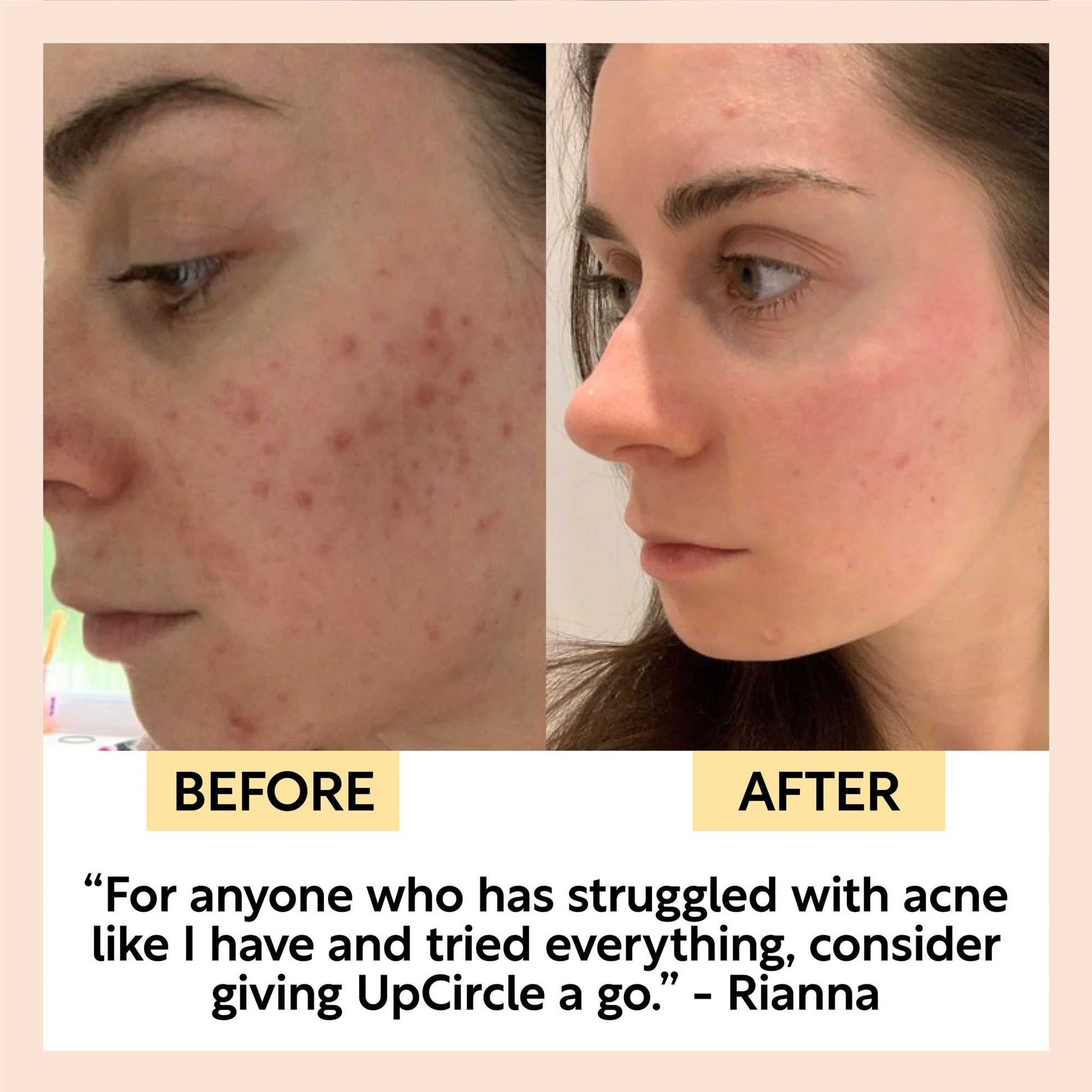 Cleanse, Tone + Moisturize Set - M2G