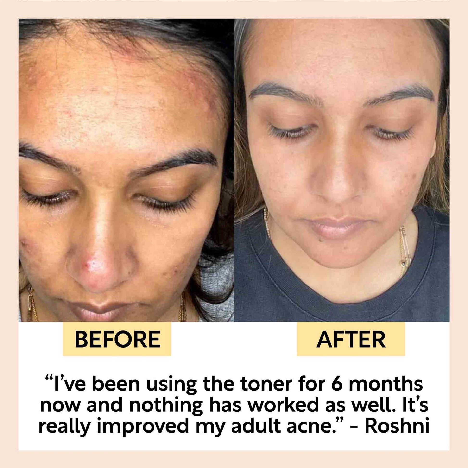 Face Toner with Hyaluronic Acid - M2G