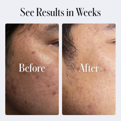 Geologie Clear System Skin Repair Moisturizer 0.2% Retinol 2 fl oz - Imperfect Box - M2G