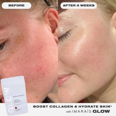 Imarais Beauty Glow Skincare Gummies Vegan and Sugar-Free 30ct - Imperfect Container - M2G