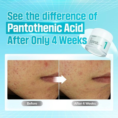 numbuzin No.1 Pantothenic B5 Active Soothing Face Cream 2.7 fl oz - Imperfect Box - M2G