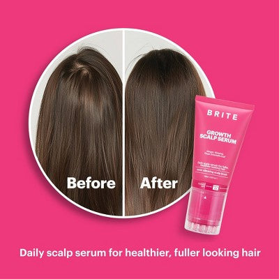BRITE Growth Scalp Serum with Applicator 3.38 fl oz - Imperfect Box - M2G