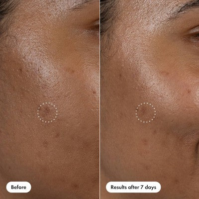 Hero Cosmetics Dark Spot Correct 10ml - New - M2G