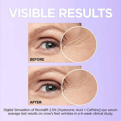 L'Oreal Paris Revitalift Derm Intensives Hyaluronic Acid+Caffeine 0.67 fl oz - Imperfect Box - M2G