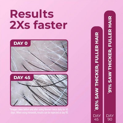 BosleyMD Revive + Densifying Hair Regrowth Serum for Women 1 fl oz - Imperfect Box - M2G