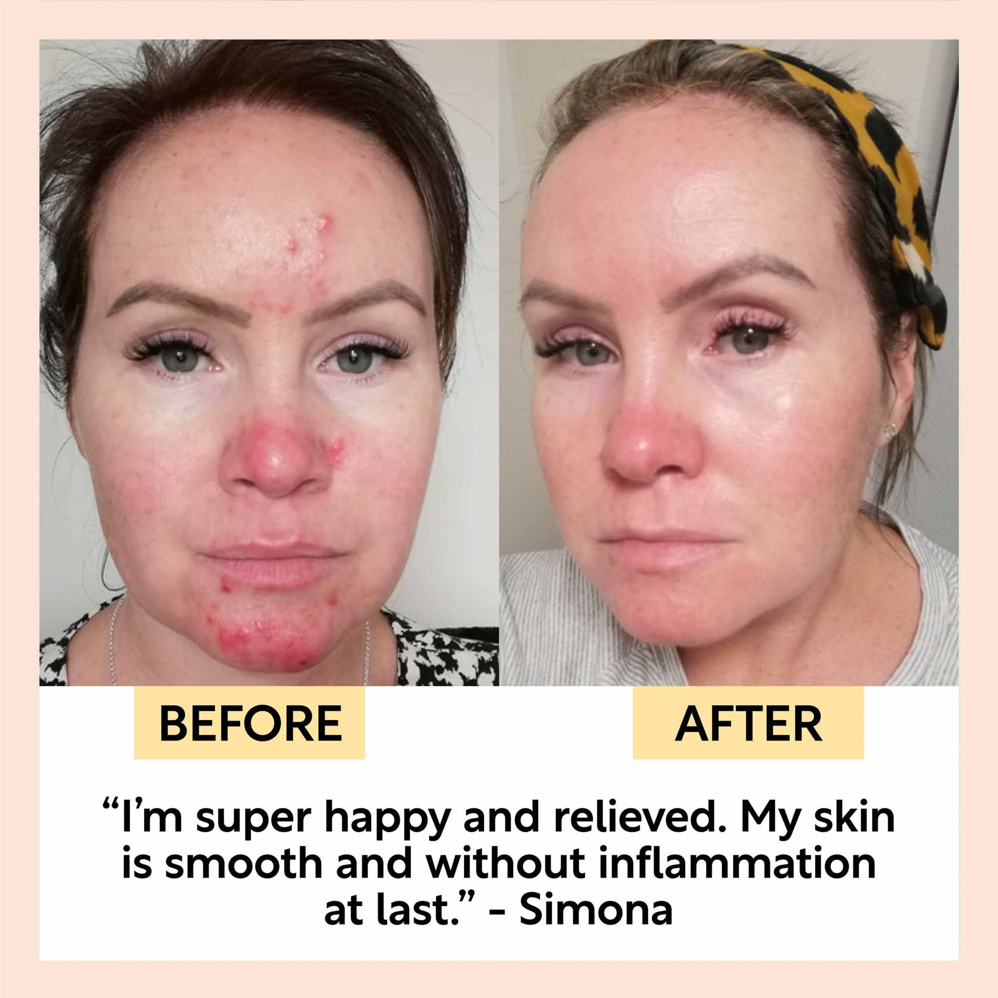Night Cream with Hyaluronic Acid + Niacinamide - M2G