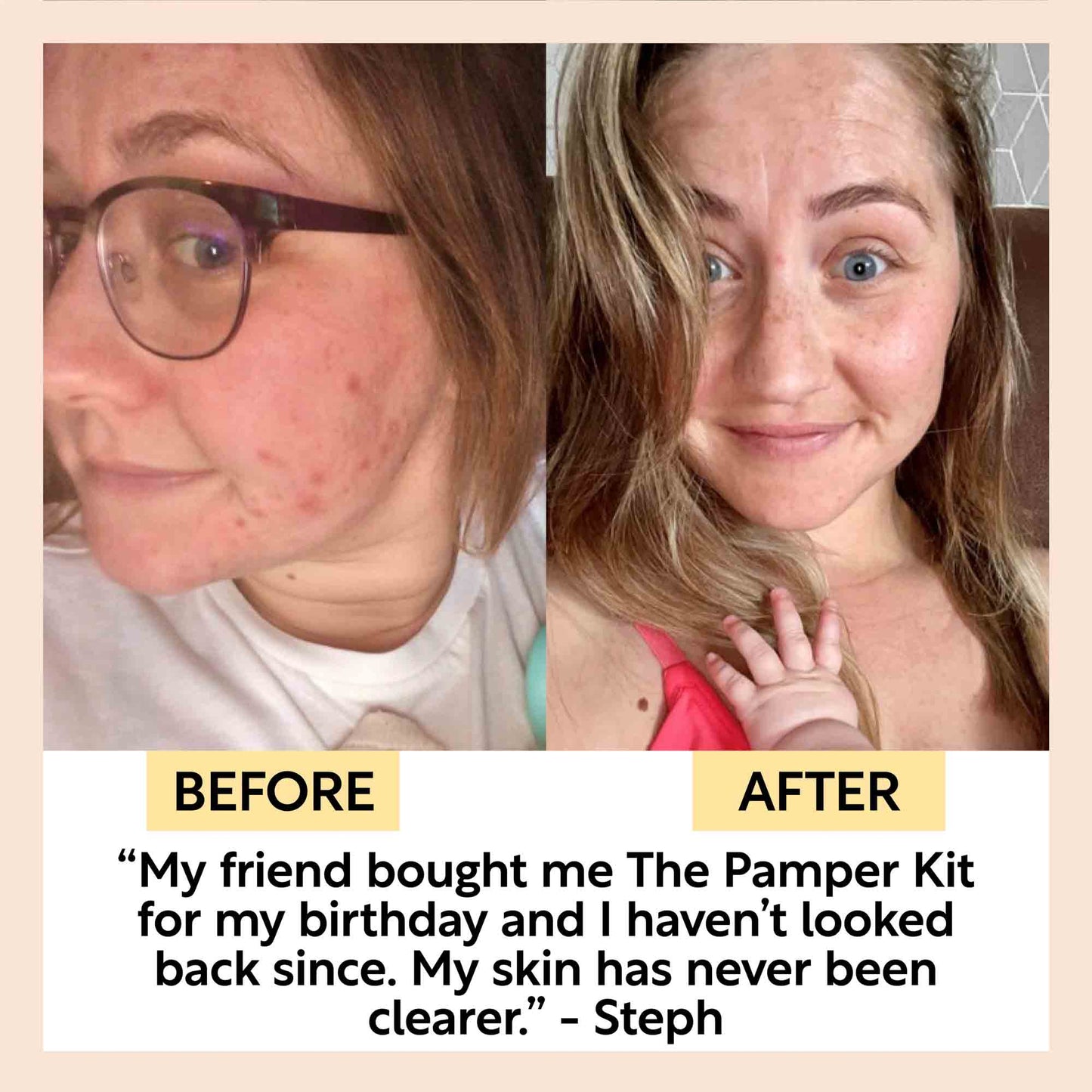 "Pamper + Gift" Skincare Kit - M2G