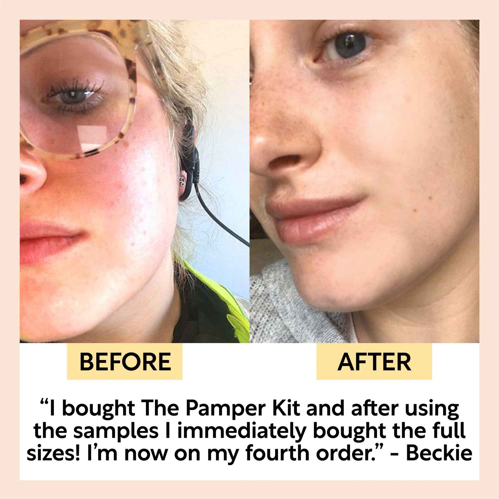 The Pamper Kit - M2G
