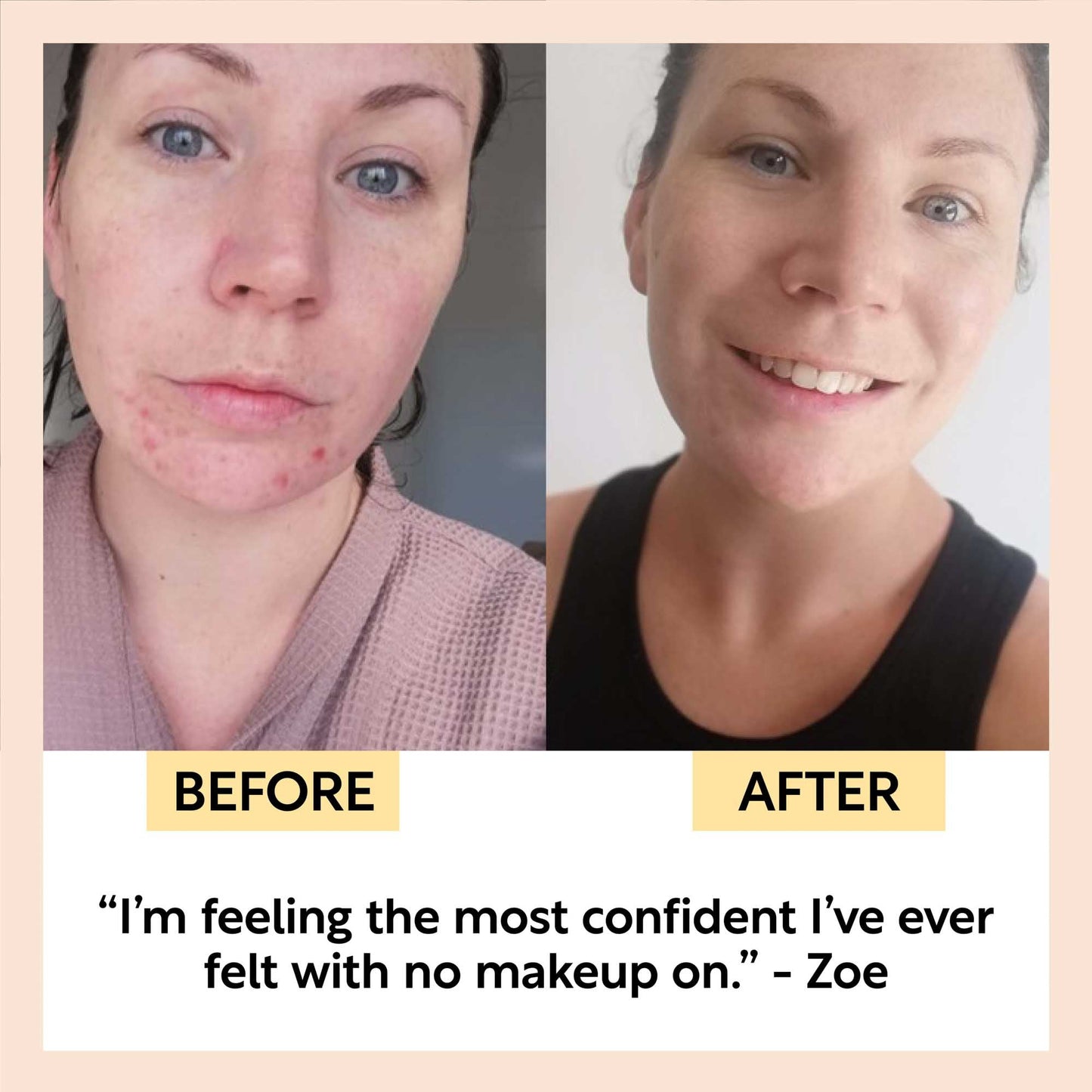 Travel-Size Skincare Bundle - M2G