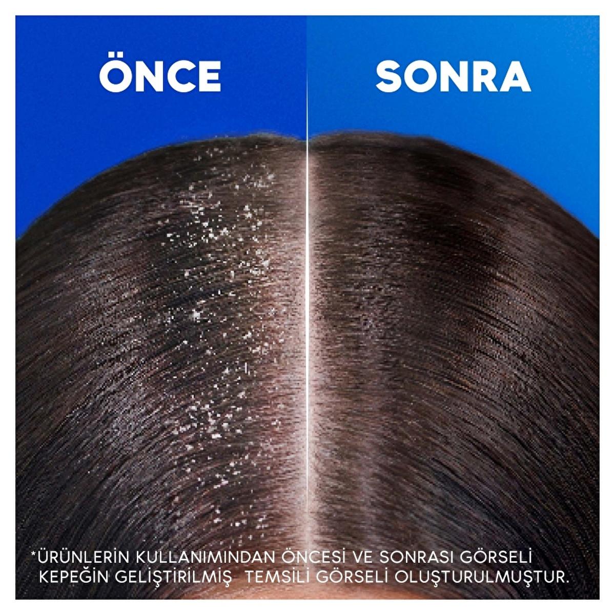 Head & Shoulders Extra Volume Dandruff Shampoo - 330ml