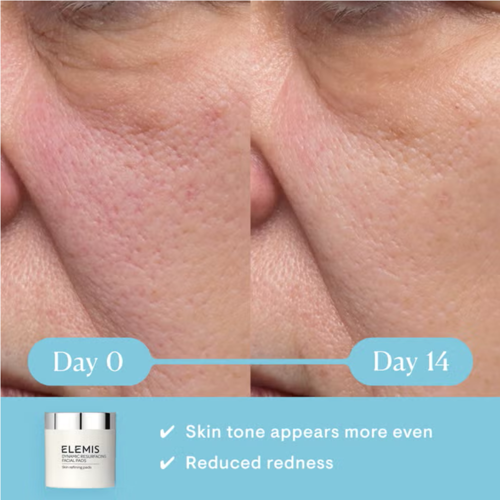 Elemis Dynamic Resurfacing Facial Pads 60pk - M2G