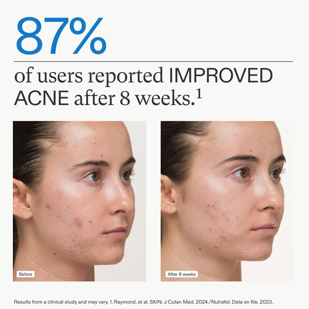 Nutrafol Clear Skin Nutraceutical Acne Supplement 3-Month Supply - M2G