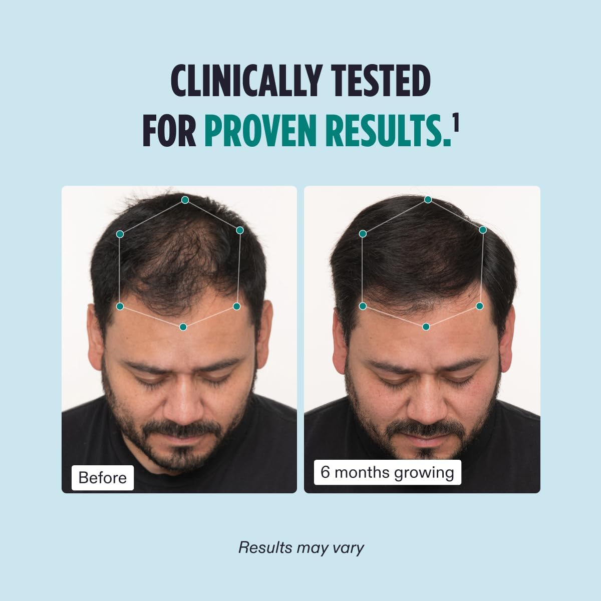 Nutrafol Men's Hair Growth Supplement 3-Month Supply - M2G