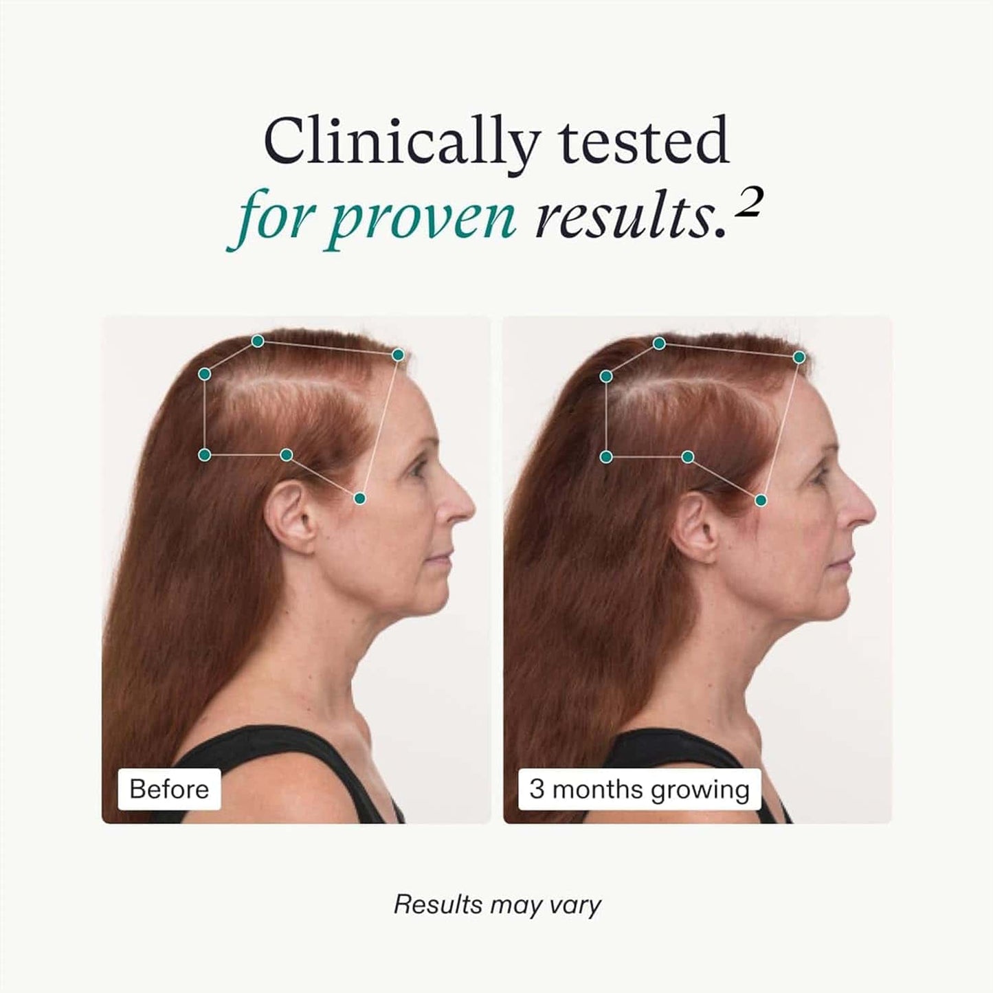 Nutrafol Women's Balance Hair Growth Pack 3-Month Supply - M2G