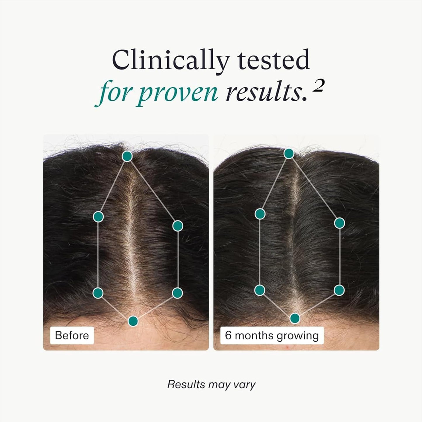 Nutrafol Women's Hair Growth for Thicker, Stronger Hair 3-Month Supply - M2G